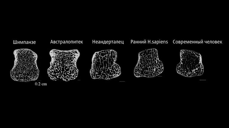 У современных людей менее плотные кости У современных людей менее плотные кости