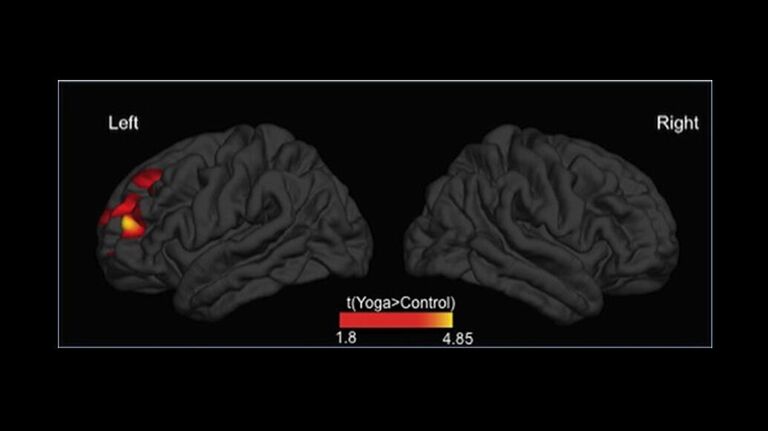 Различия в толщине коры головного мозга Различия в толщине коры головного мозга