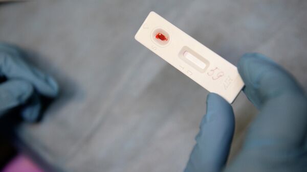 Экспресс-анализ крови в мобильном пункте центра профилактики и лечения ВИЧ-инфекции