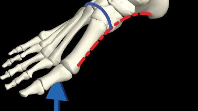 Схема скелета стопы с указанием продольной (красным) и поперечной (синим) арок и типичной схемы нагрузки во время передвижения