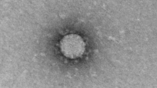 Первые кадры нового коронавируса SARS-CoV-2 под микроскопом