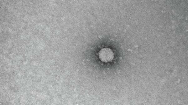 Фотоснимок коронавируса
