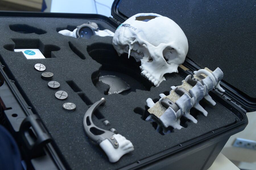 Эндопротезы, напечатанные на 3D-принтере