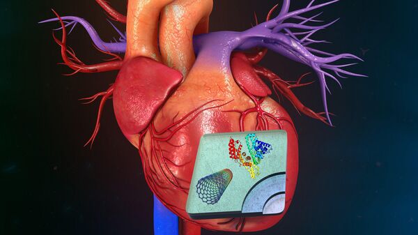 Схема нанокомпозитной конструкции на инфаркте миокарда сердца