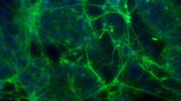 Дофаминергические нейроны человека