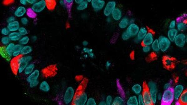 Выращенный в лаборатории мини-кишечник с резко увеличенным количеством энтероэндокринных клеток. Различные гормоны показаны красным, фиолетовым и зеленым