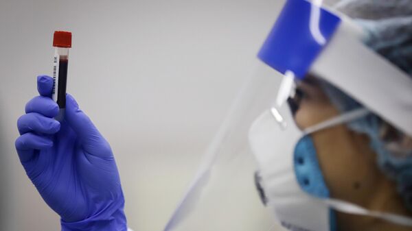 Медицинский работник держит в руках пробирку с биоматериалом для тестирования на наличие антител к коронавирусу
