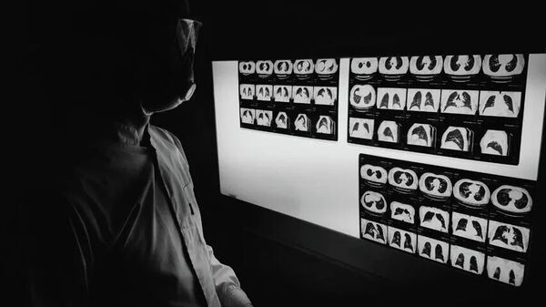 Компьютерная томография в Хасавюрте