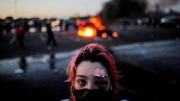 Девушка с травмами, полученными во время протестов в Миннеаполисе