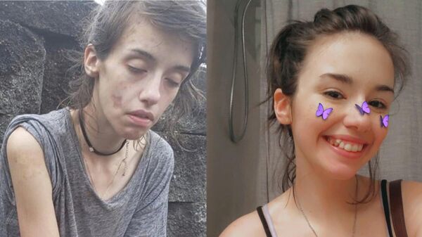 Девушка до и после избавления от наркотической зависимости