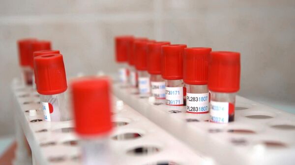 Пробирки с кровью для анализа перед выпиской добровольцев испытаний вакцины от коронавируса в Главном военном клиническом госпитале имени Н. Н. Бурденко