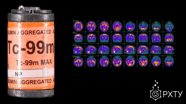 Изображения головного мозга при болезни Альцгеймера, полученные с помощью изотопа технеция 