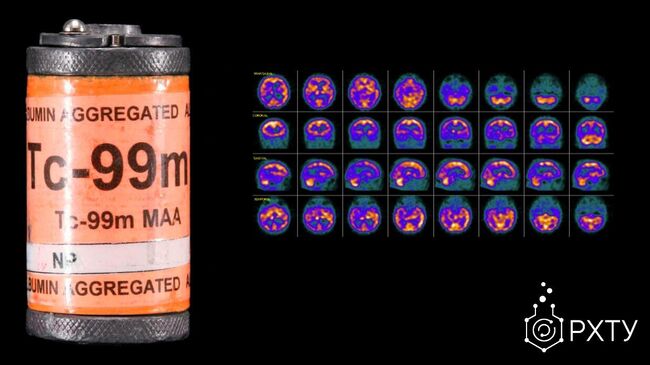 Изображения головного мозга при болезни Альцгеймера, полученные с помощью изотопа технеция 