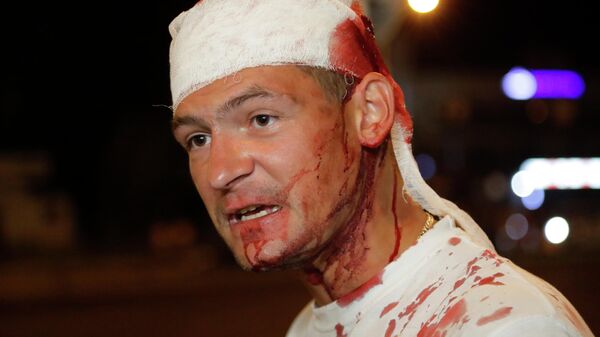 Раненный мужчина после  столкновений с полицией на протесте в Минске, Беларусь. 10 августа 2020