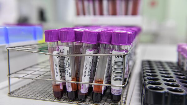 Производство тестов на антитела