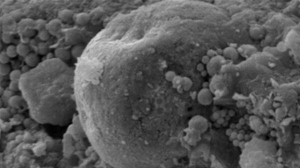 Снимок окаменелых микроорганизмов, обнаруженных внутри метеорита Оргей
