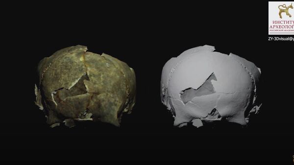3D-моделирование трепанации черепа (село Льговское, Восточный Крым)