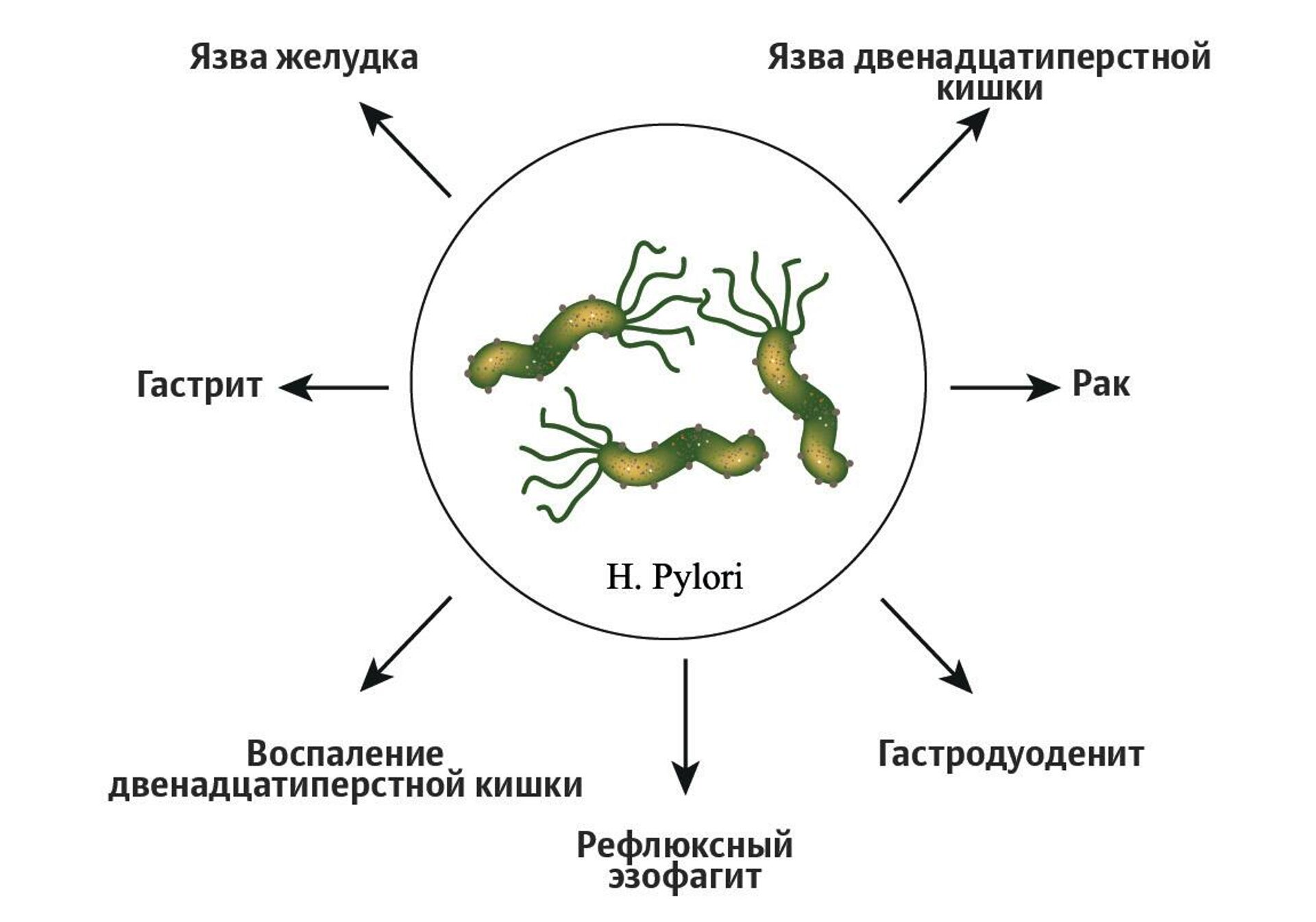 Болезни, вызванные Helicobacter pylori - РИА Новости, 1920, 27.10.2020