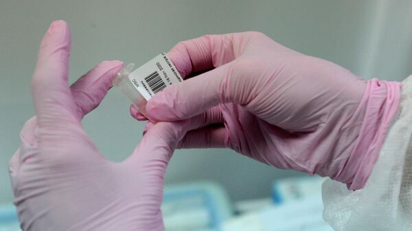 Медицинская сестра наклеивает индивидуальный штрих код на пробирку с ПЦР-тестом на коронавирус COVID-19