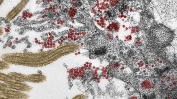 Реснитчатые ​​клетки обонятельной слизистой оболочки, инфицированные вирусом SARS-CoV-2 (красный), под электронным микроскопом