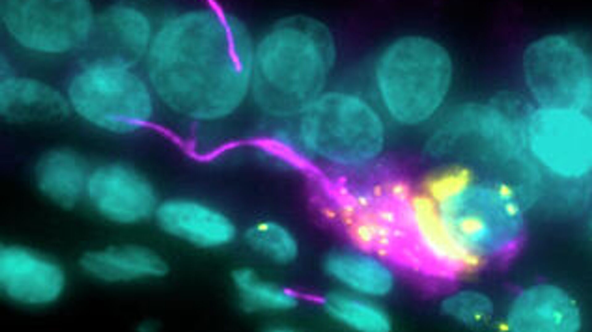 Нервная клетка (розовая), инфицированная коронавирусом (желтым) - РИА Новости, 1920, 20.12.2020