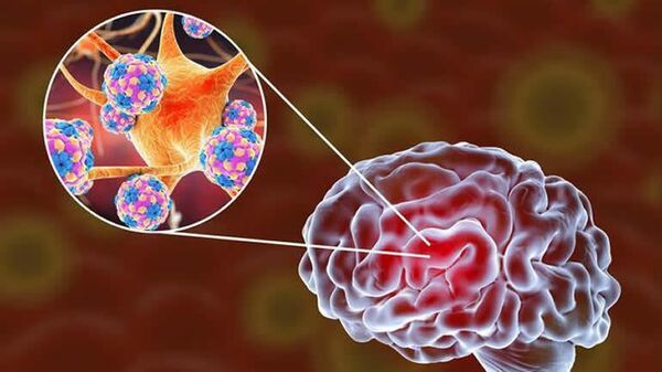  SARS-CoV-2 инфицирует органоиды головного мозга человека