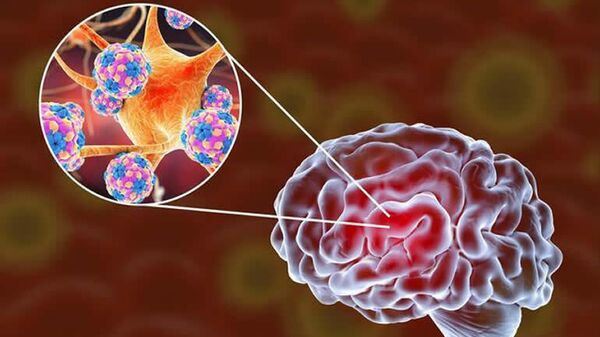  SARS-CoV-2 инфицирует органоиды головного мозга человека