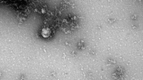 Фотография под микроскопом британского штамма коронавируса