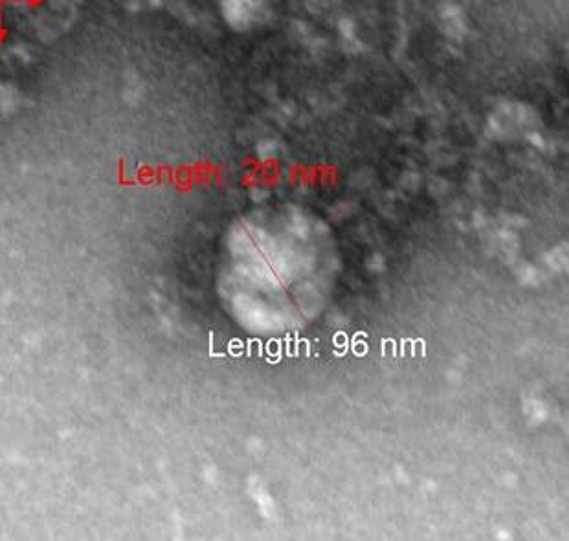 Фотография под микроскопом британского штамма коронавируса - РИА Новости, 1920, 25.01.2021