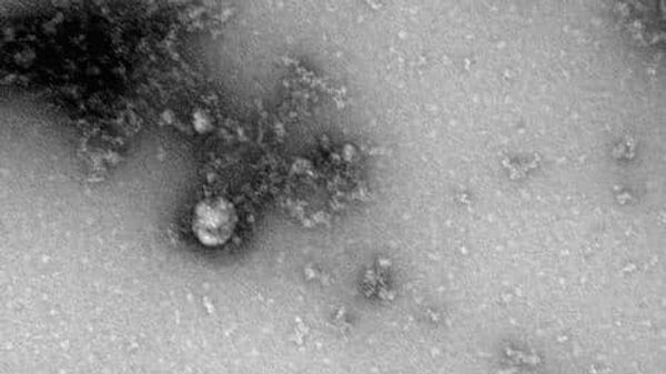 Изображение британского штамма нового коронавируса, полученное учеными института Вектор