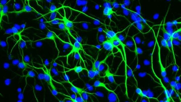 Рождение новых нейронов из стволовых клеток