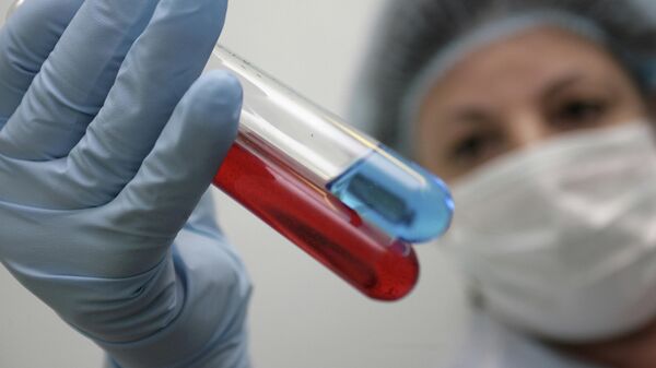 Исследование крови животных и людей на наличие вирусов свиного и птичьего гриппа
