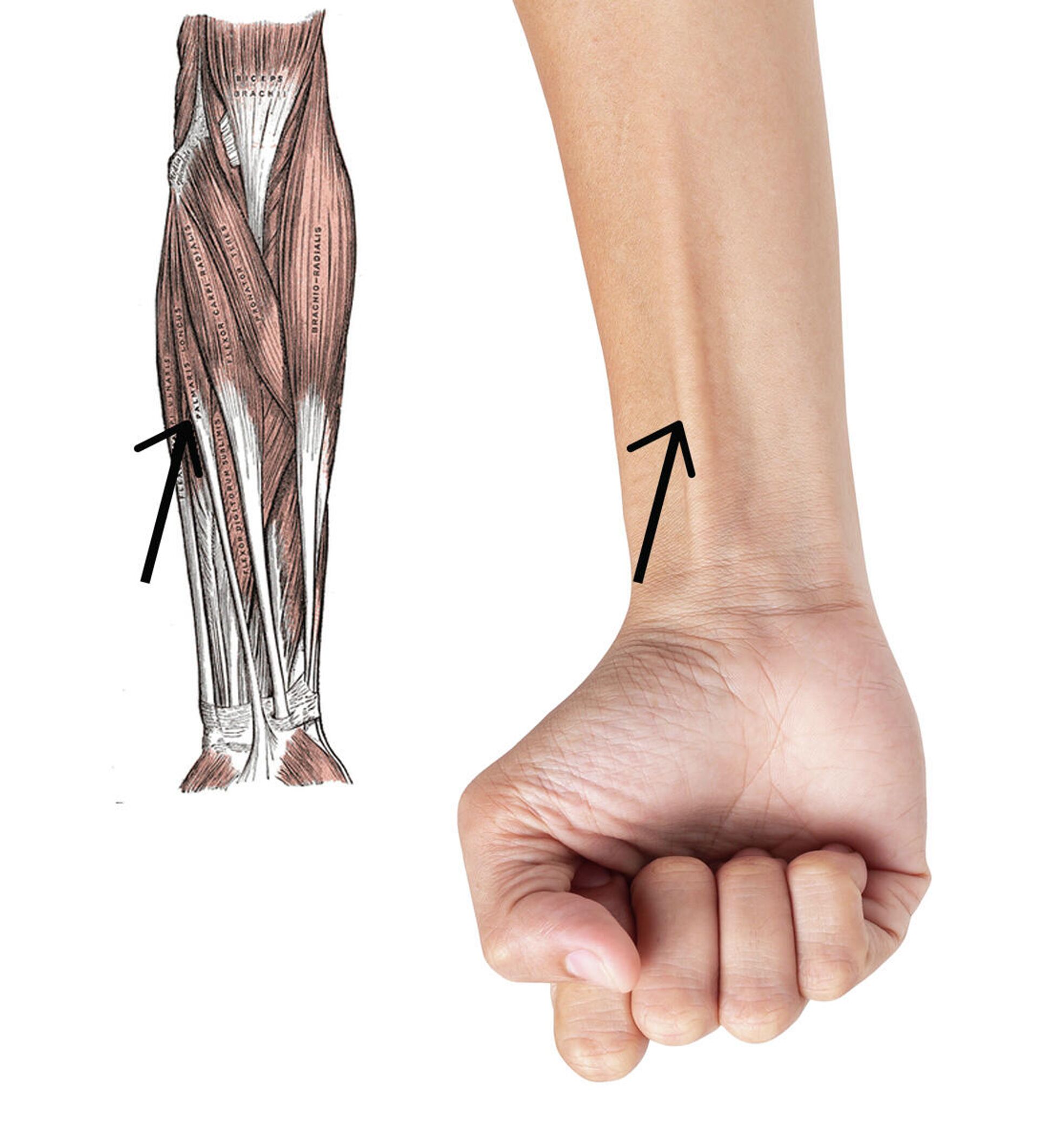 Longus Colli muscle