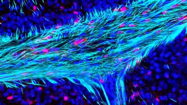 Нервные волокна в мозолистом теле, соединяющем левое и правое полушария мозга. Голубой — миелин; пурпурный — клетки — предшественники олигодендроцитов; синий — ядра клеток мозга
