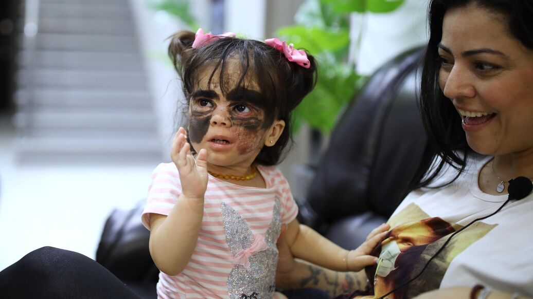 Девочке из США в "маске Бэтмена" сделали операцию в Петербурге