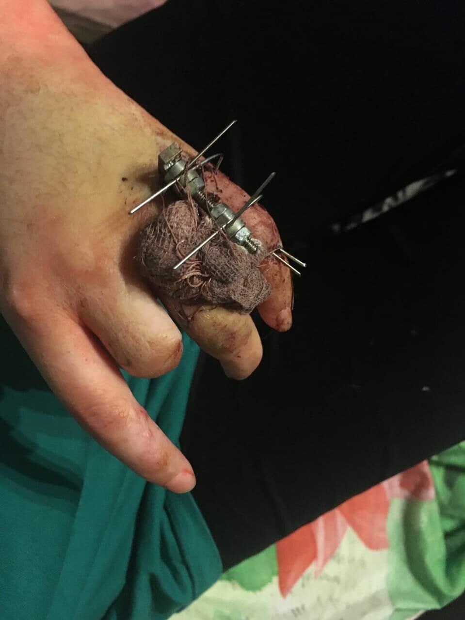 Левая рука Гули - РИА Новости, 1920, 22.03.2021