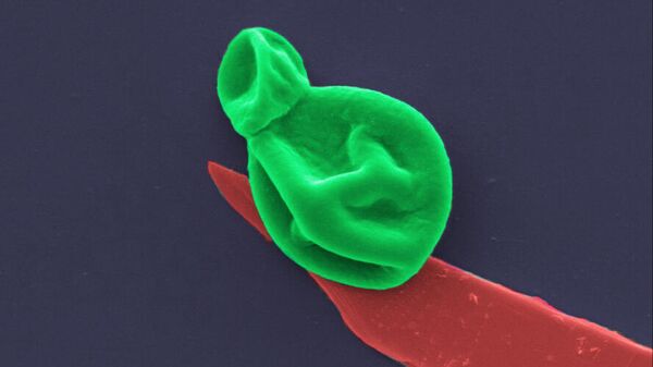 Клетка грибка (зеленая) разрушается в результате взаимодействия с нанотонким слоем черного фосфора (красный). Изображение увеличено в 25 000 раз