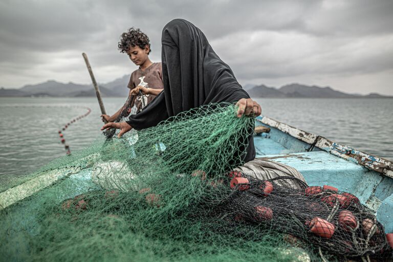 Yemen: Hunger, Another War Wound фотографа Pablo Tosco, занявшего первое место в категории Проблемы современности. Одиночное фото в фотоконкурсе World Press Photo