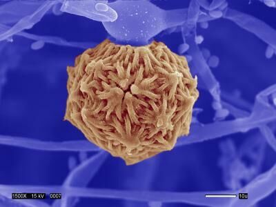 Зигоспора патогенного грибка Mucor circinelloides - РИА Новости, 1920, 28.05.2021