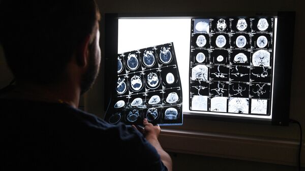 Врач рассматривает снимки томограммы головного мозга
