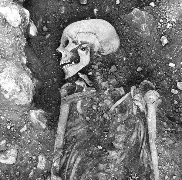 Скелет викинга возрастом 1200 лет, умершего от оспы Скелет викинга возрастом 1200 лет, умершего от оспы