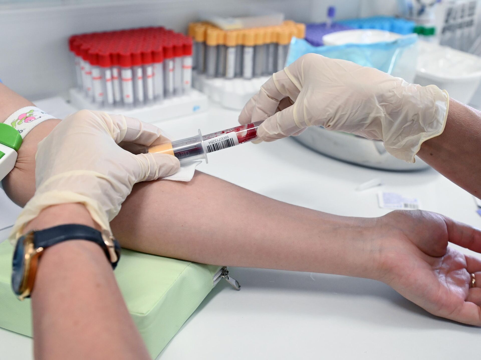 Общий анализ крови: как расшифровать?
