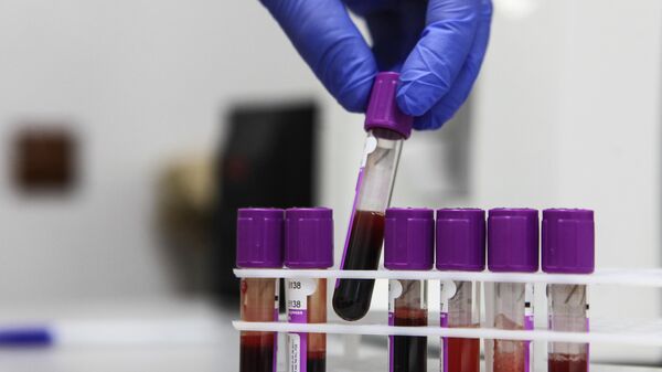 Пробирки с образцами крови в лаборатории онкологического диспансера
