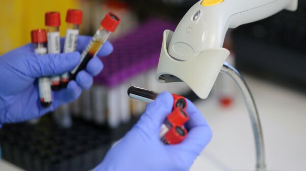 Пробирки с пробами крови в лаборатории