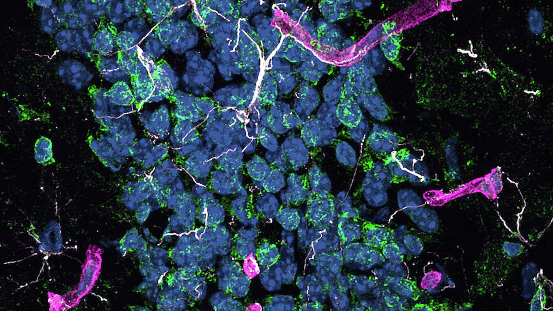 Фрагмент гиппокампа мышей с болезнью Альцгеймера. Проявления нейродегенерации: белым - активация астроцитов; зеленым - окислительный стресс; пурпурным - активация окружающих церебральных капилляров. Синим - ядра клеток - РИА Новости, 1920, 14.09.2021