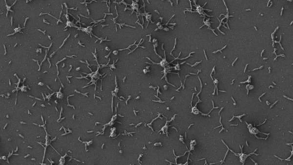 Изображение клеток Mycoplasma pneumoniae, полученное с помощью сканирующего электронного микроскопа