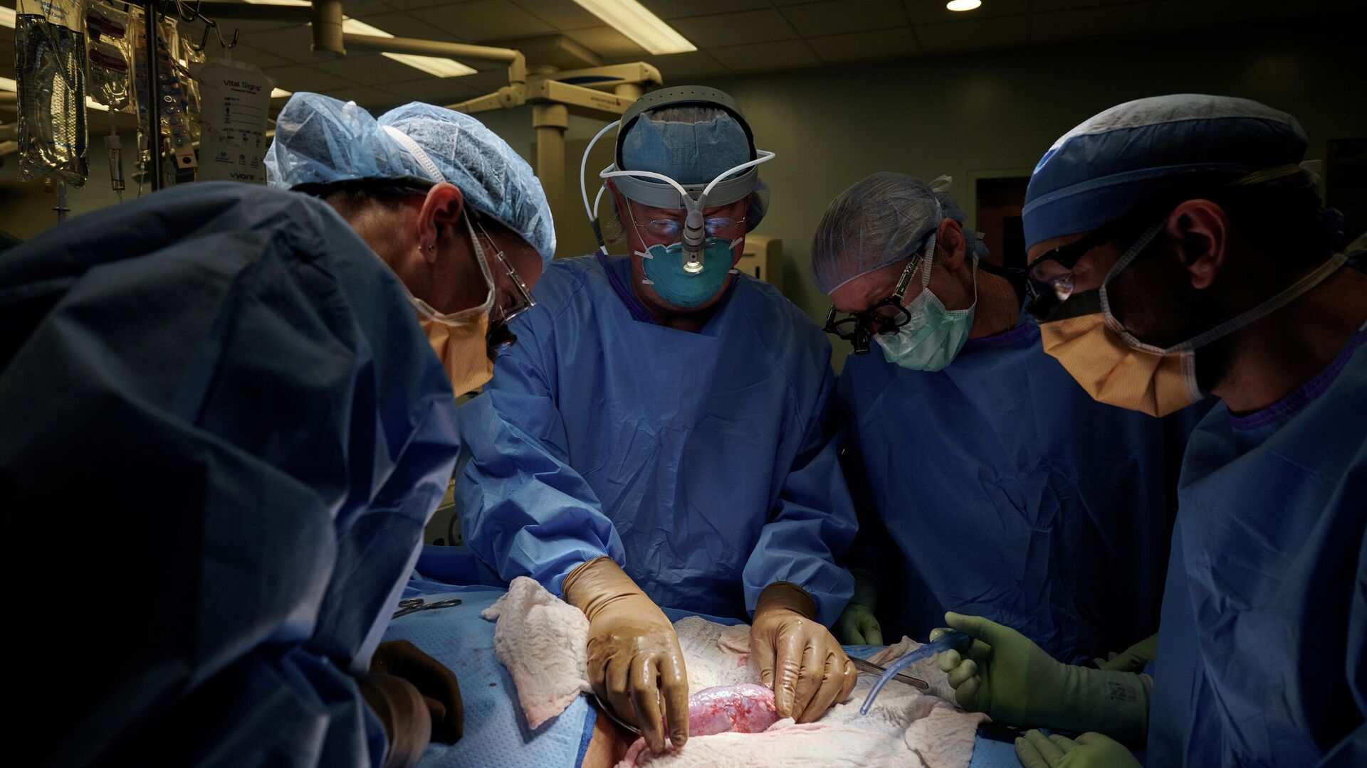 Операция по пересадке почки генно-модифицированной свиньи человеку в Медицинском центре Лангон при Университете Нью-Йорка - РИА Новости, 1920, 20.10.2021