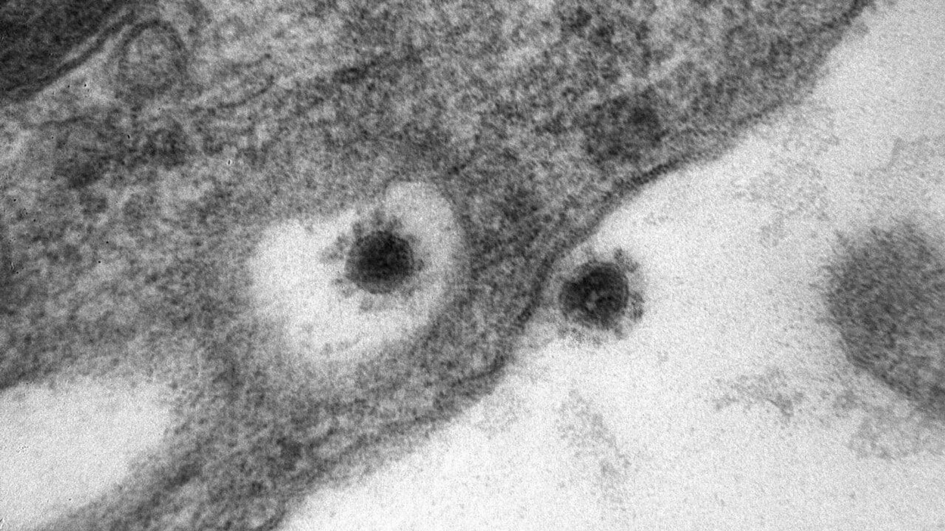 Фото дельта-штамма коронавируса, опубликованное научным центром Вектор - РИА Новости, 1920, 25.10.2021