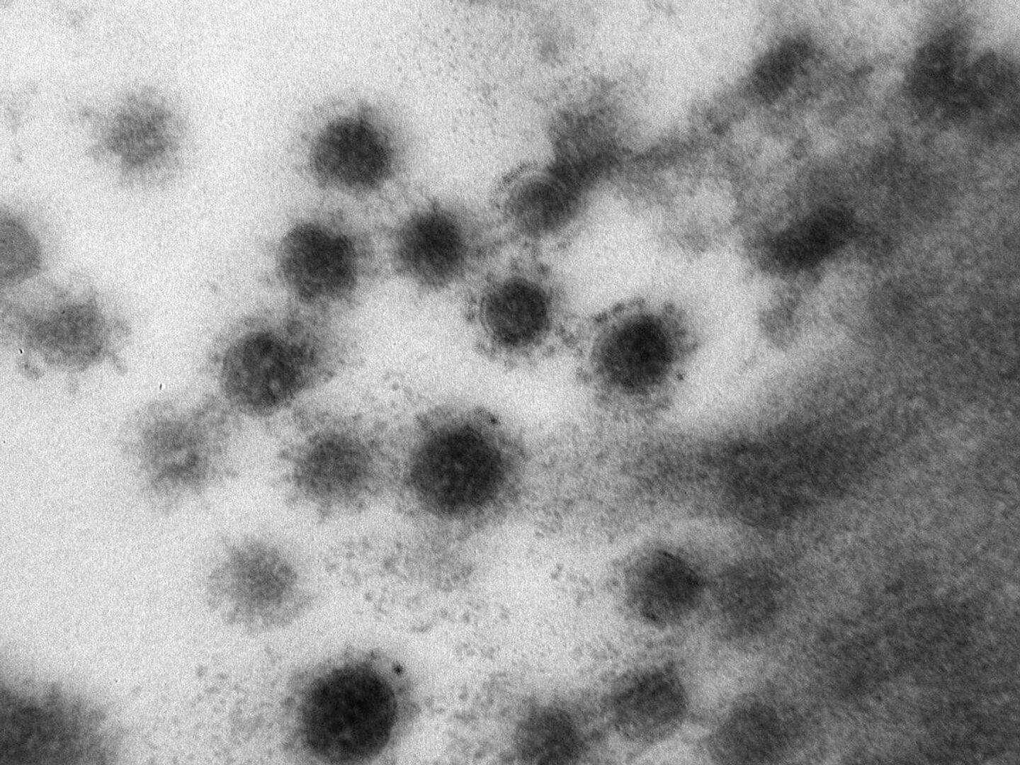 Ковид смертелен. Вирус Covid 19 под микроскопом. Дельта штамм коронавируса под микроскопом. SARS-cov-2 Дельта штамм. Вирус коронавирус микроскоп.