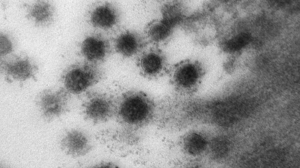 Фото дельта-штамма коронавируса, опубликованное научным центром Вектор